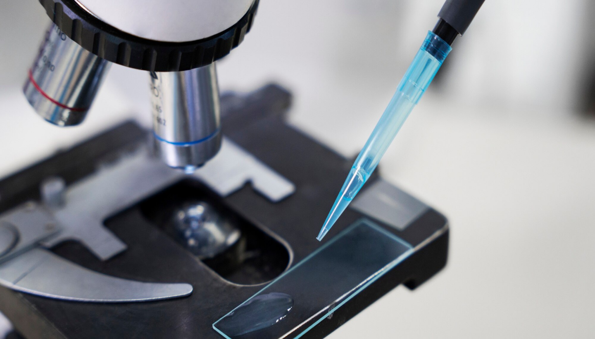 Liver Diagnosis